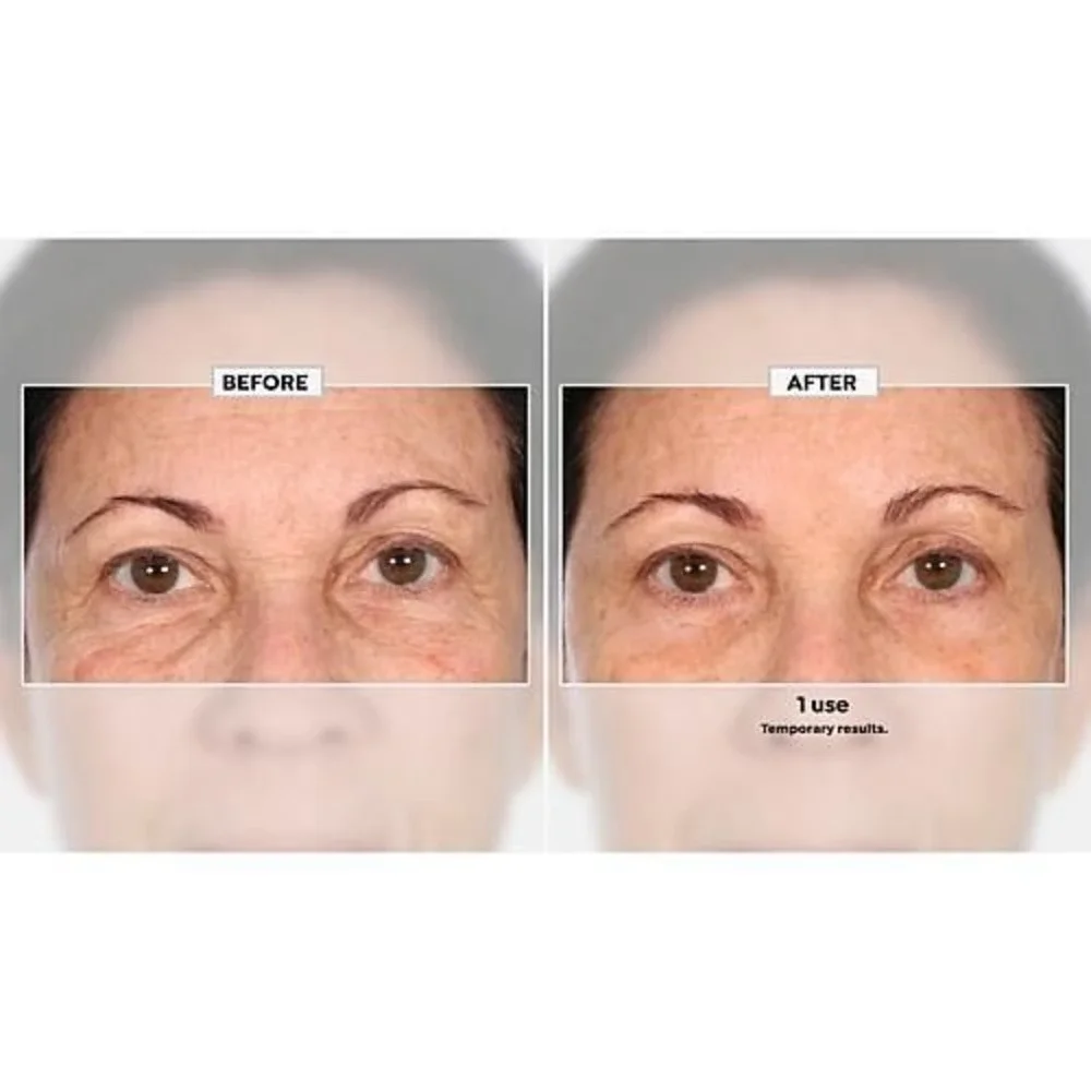 Nakery Beauty Advanced Instant Wrinkle Eraser